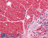 Anti-DISC1 Antibody (C-Terminus) IHC-plus LS-B2805