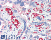 Anti-IL18 Antibody IHC-plus LS-B2809