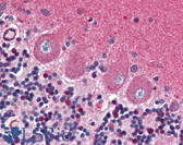 Anti-GRIA2 / GLUR2 Antibody (aa175-430) IHC-plus LS-B2811