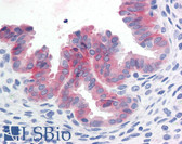 Anti-c-Met Antibody (Cytoplasmic Domain) IHC-plus LS-B2812
