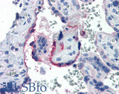 Anti-CYP19 / Aromatase Antibody IHC-plus LS-B2816