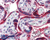 Anti-PPARG / PPAR Gamma Antibody (aa1-16) IHC-plus LS-B2818