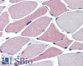 Anti-TRPA1 Antibody (N-Terminus) IHC-plus LS-B2819