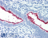 Anti-MUC16 / CA125 Antibody (clone X306) IHC-plus LS-B2829
