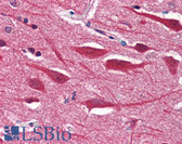 Anti-STX2 / Syntaxin 2 Antibody (aa1-19) IHC-plus LS-B2834