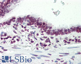 Anti-HMG1 / HMGB1 Antibody IHC-plus LS-B2841
