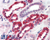 Anti-GGA3 Antibody (C-Terminus) IHC-plus LS-B2853