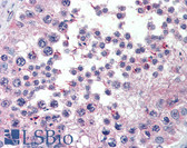 Anti-XPO7 / RANBP16 Antibody (C-Terminus) IHC-plus LS-B2854