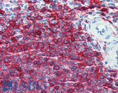 Anti-HLA-DRA Antibody (clone TAL 1B5) IHC-plus LS-B2858