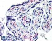 Anti-IL1R1 Antibody (Extracellular Domain, clone 40101) IHC-plus LS-B2859