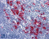 Anti-CD68 Antibody (clone KP1) IHC-plus LS-B2862