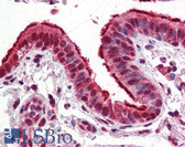 Anti-FOXP1 Antibody (clone JC12) IHC-plus LS-B2866