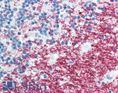 Anti-PLP1 / Myelin PLP Antibody (C-Terminus, clone plpc1) IHC-plus LS-B2867