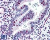 Anti-ERCC4 / XPF Antibody IHC-plus LS-B2868