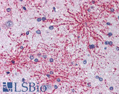 Anti-BAIAP2 / IRSP53 Antibody (Isoform 1) IHC-plus LS-B2869