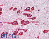 Anti-MAOB / Monoamine Oxidase B Antibody (Internal) IHC-plus LS-B2871