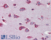 Anti-DNM3 / Dynamin 3 Antibody (aa623-639) IHC-plus LS-B2880
