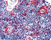 Anti-KRT13 / CK13 / Cytokeratin 13 Antibody (clone AE8) IHC-plus LS-B2884