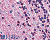 Anti-ENO2 / NSE Antibody (clone NSE-P1) IHC-plus LS-B2890