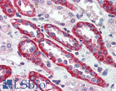 Anti-CASR/Calcium Sensing Receptor Antibody (N-Terminus) IHC-plus LS-B2894