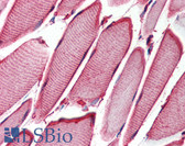 Anti-HSPB6 / HSP20 Antibody IHC-plus LS-B2899