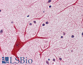 Anti-CHUK / IKKA / IKK Alpha Antibody (C-Terminus) IHC-plus LS-B2900