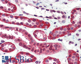 Anti-IGF1R / IGF1 Receptor Antibody (aa1264-1367, clone JBW902) IHC-plus LS-B2905