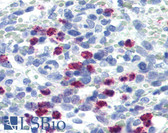 Anti-FBXW7 / FBW7 Antibody (Internal) IHC-plus LS-B2909
