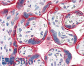 Anti-EGFR Antibody (Internal) IHC-plus LS-B2914