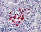 Anti-VHL / Von Hippel Lindau Antibody (clone 52A11) IHC-plus LS-B2927
