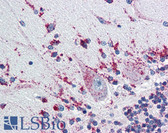 Anti-CTSD / Cathepsin D Antibody (clone 4G2) IHC-plus LS-B2931