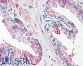 Anti-HSPB1 / HSP27 Antibody (aa1-205, clone 2A5) IHC-plus LS-B2932
