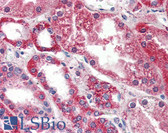 Anti-PSPH Antibody (aa1-225, clone 3G12) IHC-plus LS-B2935
