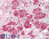 Anti-NT5E / eNT / CD73 Antibody (aa27-252, clone 2B6) IHC-plus LS-B2943