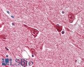 Anti-YWHAE / 14-3-3 Epsilon Antibody (aa1-255, clone 5A5) IHC-plus LS-B2948