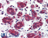Anti-FOLH1 / PSMA Antibody (aa117-351, clone K1H7) IHC-plus LS-B2950
