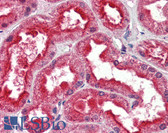 Anti-FOLH1 / PSMA Antibody (aa117-351, clone K2G3) IHC-plus LS-B2952