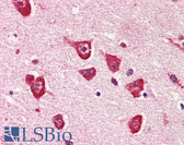 Anti-PPM1G Antibody (aa317-546, clone K1G6) IHC-plus LS-B2960