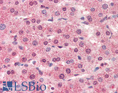 Anti-CTSL / Cathepsin L Antibody (aa114-333, clone 2H7) IHC-plus LS-B2962