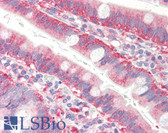 Anti-CFL1 / Cofilin Antibody (aa1-166, clone AT1C1) IHC-plus LS-B2971