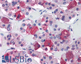 Anti-ACTH Antibody (N-Terminus, clone 57) IHC-plus LS-B2977
