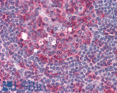 Anti-TUBA1 / Tubulin Alpha 1 Antibody (N-Terminus) IHC-plus LS-B2980