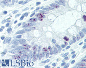 Anti-MKI67 / Ki67 Antibody (C-Terminus) IHC-plus LS-B2984