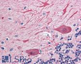 Anti-STX2 / Syntaxin 2 Antibody (aa1-19) IHC-plus LS-B2991
