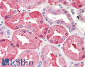 Anti-FABP1 / L-FABP Antibody (aa1-127, clone 2G4) IHC-plus LS-B3001