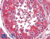 Anti-EPHA2 / EPH Receptor A2 Antibody (aa559-976, clone 3D7) IHC-plus LS-B3002