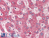 Anti-ROBO1 Antibody (Internal) IHC-plus LS-B3011