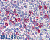 Anti-CD14 Antibody (Internal) IHC-plus LS-B3012