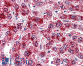 Anti-CAT / Catalase Antibody (Internal) IHC-plus LS-B3014