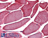 Anti-VRL1 / TRPV2 Antibody (Internal) IHC-plus LS-A8739